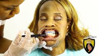 TEETH WHITENING TUTORIAL How to Start a TEETH Whitening Business amp Is Teeth Whitening Legal [upl. by Asilehc]