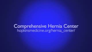 Hernia Surgery Complex Hernia Repair [upl. by Dessma190]