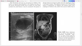 PAEDIATRIC IMAGING [upl. by Neleh]