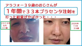 プラセンタ注射を１年間で３３本継続して打ち続けた結果をお話致します。プラセンタ注射についてまとめております。 [upl. by Shannah]