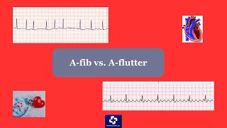 Atrial fibrillation vs Atrial Flutter [upl. by Nalo]