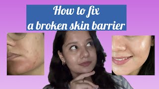 How to fix a broken skin barrier  DrRakshita [upl. by Theo]