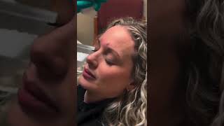 Trying to Smoothen Wrinkles Try Dysport  a Botox Alternative dysport injection viralvideo [upl. by Onairotciv238]