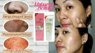 NATURE BEAUTY COLLAGEN amp GLUTATHIONE INSTANT PEELING MAGIC CREAM 1ST TIME USERIN JUST 7 DAYS [upl. by Biernat]