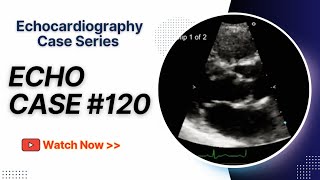 Echocardiography Case 120  Echo Spot Diagnosis Case Series [upl. by Assena]