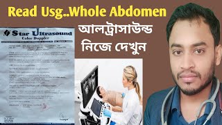 আল্ট্রাসনোগ্রাফি রিপোর্ট  Usg Whole Abdomen Bengali  Ultrasound Report [upl. by Henig351]