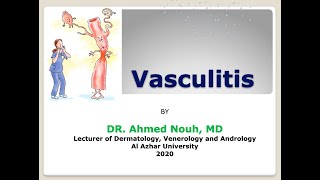 Vasculitis for Arabic students [upl. by Sirret]