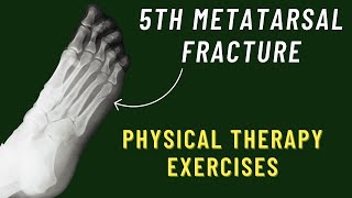 شرح كل كسور استقبال العظام فى ساعتين  2 Fracture Base Of Fifth Metatarsal Bone [upl. by Ayaladnot]