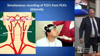 Head Turn Syncope Rotational Vertebrobasilar Ischemia by David Newell MD [upl. by Notsnorb]