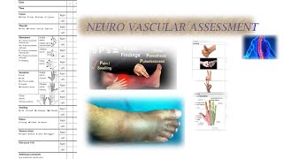 NEUROVASCULAR ASSESSMENT [upl. by Prem513]