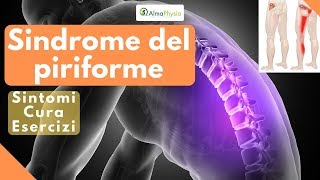 Sindrome del piriforme sintomi cura esercizi [upl. by Martguerita]