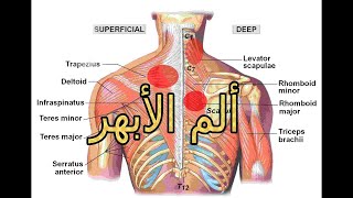 Rhomboid trigger pointsT4 syndrome Physical Therapy Physiotherapy  خطورة طق أو طج الأبهر [upl. by Ahon11]