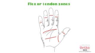 Basic sciences  Flexor tendon zones [upl. by Laurella]