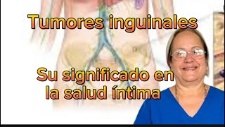 Tumores inguinales Que pueden significar para la salud íntima [upl. by Hyozo569]