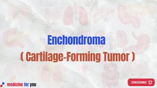 Enchondroma  CartilageForming Tumor [upl. by Weight]