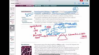 Hyperaldosteronism endocrinology 77  First Aid USMLE Step 1 in UrduHindi [upl. by Ytsirt381]