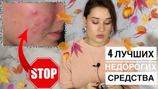 КАК ИЗБАВИТЬСЯ ОТ ПОДКОЖНЫХ ПРЫЩЕЙ ЗА 1 ДЕНЬ  4 ЛУЧШИХ КОПЕЕЧНЫХ СРЕДСТВА [upl. by Aleafar]