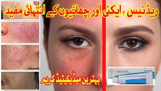 Advantan cream uses and benefits methylprednisolone side effects How to use for skin infections [upl. by Boleyn]