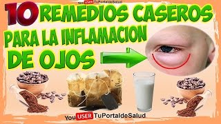 Como Curar la Inflamación de Ojos o Blefaritis con 10 Remedios Caseros [upl. by Ahseinar681]