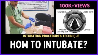 HOW TO INTUBATE INTUBATION PROCEDURE amp TECHNIQUE [upl. by Siurad546]