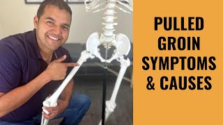 Pulled Groin Muscle Everything You Absolutely Need To Know [upl. by Zebapda]