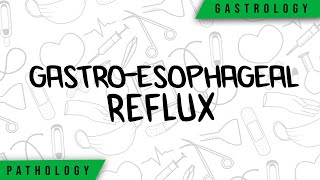 GastroEsophageal Reflux  Physiopathology Symptoms Complications Treatment [upl. by Georgine]