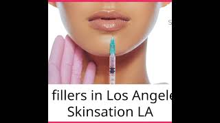 Lip fillers in Los Angeles  Skinsation LA [upl. by Htebazile10]