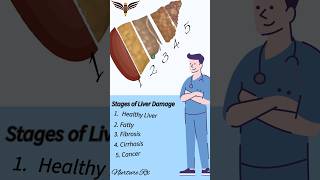 liver damage stage nursing nclex hospital emergency nurses fattyliver cancer health neet [upl. by Tselec]