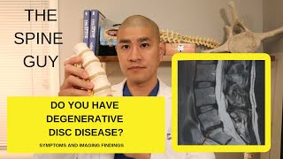 Lumbar Degenerative Disc Disease Part 1 Symptoms and Imaging [upl. by Raama]