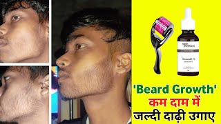 beard growth time lapse  beard growth time lapse minoxidil beard growth tips in hindibeard growth [upl. by Aiahc]