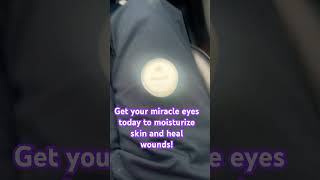 Get your miracle eyes today to moisturize skin and heal wounds heal wounds dryskin shortscream [upl. by Notsob]