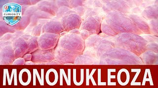 Mononukleoza Uzrok i pomoć Dr79 [upl. by Notsehc]