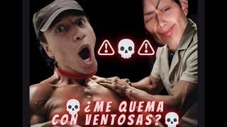 ⚠️🔥¿QUEMARÉ a mi COMPA Usando VENTOSAS por PRIMERA VEZ en ESPALDA 🔥⚠️ [upl. by Adian451]