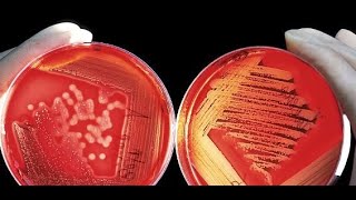 Bacteriology Part 3 Family Enterobacteriaceae Proteus Spp [upl. by Annayat281]