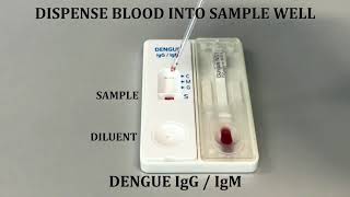 MEDEX USER GUIDE Dengue Combo NS1 Ag and IgGIgM Antibodies Test Kit [upl. by Lundeen315]