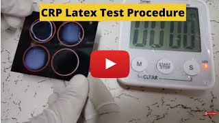 CReactive Protein Test CRP Latex Test Procedure [upl. by Jemy]