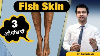 Fish Skin Disease 100 Cure in HINDI  Ichthyosis Vulgaris Permanent Cure by Jyovis Dr Raj Satpute [upl. by Otti988]