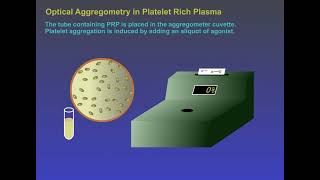 Optical Aggregation in PlateletRichPlasma [upl. by Attalie]