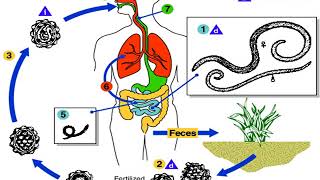 Parasitology lecture 8 Intestinal Nematodes [upl. by Acihsay]