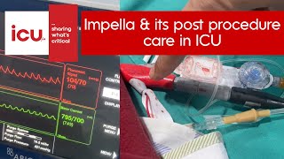 What is Impella and its post procedure care in ICU How it is different from IABP [upl. by Lednahs437]