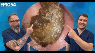 Removing Massive Ear Wax Blockages  EP1054 [upl. by Ylrak]