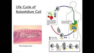 Balantidium Coli Class Ciliate Parasitology [upl. by Inavoig]