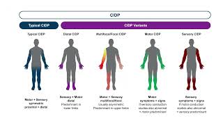 Optimizing Outcomes in CIDP Honing Diagnostic Accuracy Personalizing Treatment Plans [upl. by Millar]