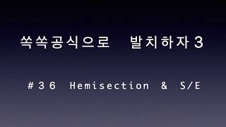 36  hemisection 단근치로 분리하여 각각 발치 [upl. by Ttevy5]