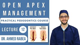 Lecture 12 Pulp Therapy in Immature permanent teeth  Open Apex Management   كورس بيدو عملي [upl. by Ahcsap]