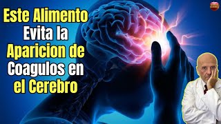 🤯 ESTE ES EL ALIMENTO QUE EVITA LA APARICION DE COAGULOS EN EL CEREBRO 🤯 [upl. by Huesman]