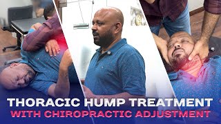 Shocking Thoracic Hump Correction Spine Fixed at Chirophysio Clinic [upl. by Buckden]