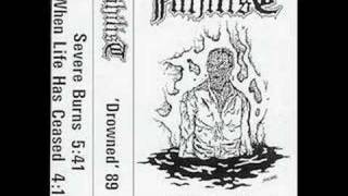 Nihilist Severe Burns Rare Drowned Demo 89 [upl. by Akisej]