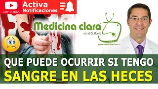 Sangre en las heces sangre con la deposición Enfermedades asociadas  Medicina Clara [upl. by Eladnek]