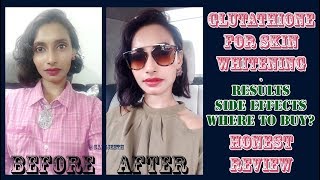 Glutathione Skin Whitening Tablets Results  Genuine Customer Review  SahiJeeth [upl. by Acissev]